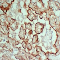 MUC16 Mouse Monoclonal Antibody