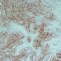 MUC16 Mouse Monoclonal Antibody