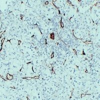 CD105 Mouse Monoclonal Antibody