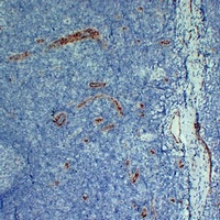 CD105 Mouse Monoclonal Antibody