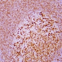 CD74 Mouse Monoclonal Antibody