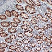 Claudin 3 Mouse Monoclonal Antibody