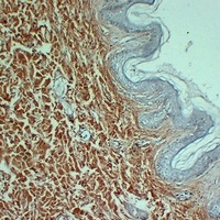 Collagen 3 alpha 1 Mouse Monoclonal Antibody