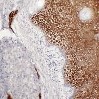 Cytokeratin 16 Mouse Monoclonal Antibody