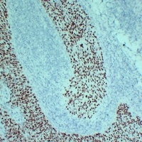 p63 Mouse Monoclonal Antibody