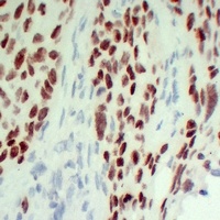 p63 Mouse Monoclonal Antibody