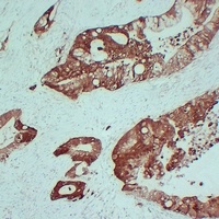 S100-A6 Mouse Monoclonal Antibody
