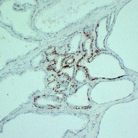 S100-A6 Mouse Monoclonal Antibody