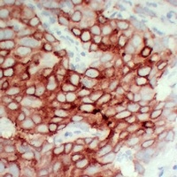 PS2 Mouse Monoclonal Antibody