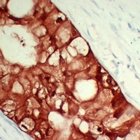 S100-A6 Mouse Monoclonal Antibody