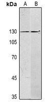 SALL4 Mouse Monoclonal Antibody