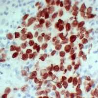 SALL4 Mouse Monoclonal Antibody