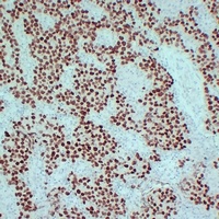 SALL4 Mouse Monoclonal Antibody