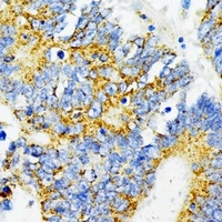 CD274 Rabbit Polyclonal Antibody