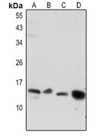 BNP Rabbit Polyclonal Antibody