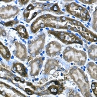 BNP Rabbit Polyclonal Antibody