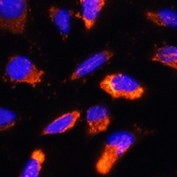 BNP Rabbit Polyclonal Antibody