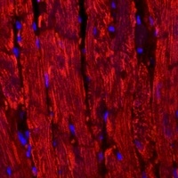 BNP Rabbit Polyclonal Antibody