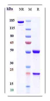 Shiga toxin (E.coli) Antibody