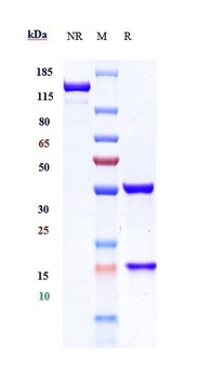CA9/Carbonic anhydrase 9 Antibody (MMAE)