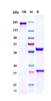 CEACAM5/CEA/CD66e Antibody (SN38)