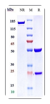 Amyloid Beta Antibody