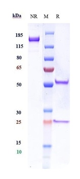 TrkB / NTRK2 Reference Antibody