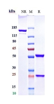 Siglec-2/CD22 Antibody