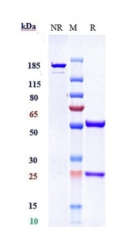 PDGFRB/CD140b Antibody