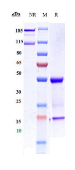 ERBB1/EGFR/HER1 Antibody