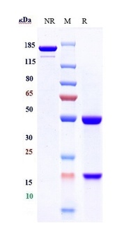 IL-17/IL-17A/CTLA-8 Antibody