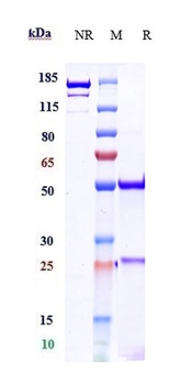 IL-17/IL-17A/CTLA-8 Antibody