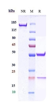 CEACAM5/CEA/CD66e Antibody