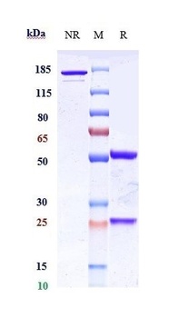 PTK7/CCK4 Antibody