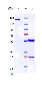 DPP4/CD26 Antibody