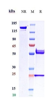 Amyloid Beta Antibody