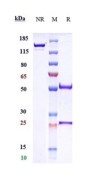 Amyloid Beta Antibody