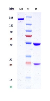KLK2/Kallikrein 2 Antibody