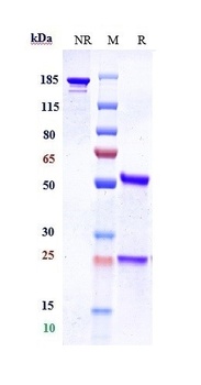 Complement Factor P / Properdin Reference Antibody