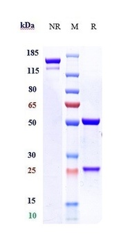 CALCRL/CALRL/CGRPR Antibody