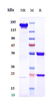IGF1-R/IGFR1/CD221 Antibody