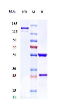 ROR1 Antibody