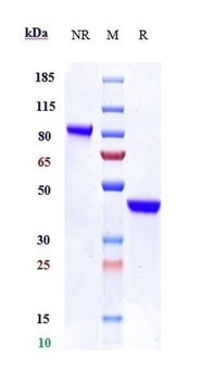 IL-17/IL-17A/CTLA-8 Antibody