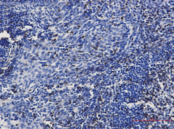 CD3 epsilon Rabbit mAb Antibody