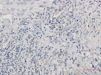 CD105 Rabbit mAb Antibody