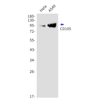 CD105 Rabbit mAb Antibody