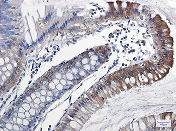 IL 18 Rabbit mAb Antibody