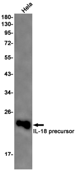 IL 18 Rabbit mAb Antibody