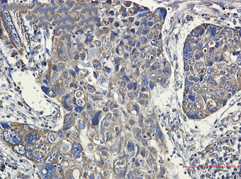 Hsp60 Rabbit mAb Antibody
