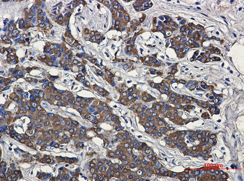 Hsp27 Rabbit mAb Antibody